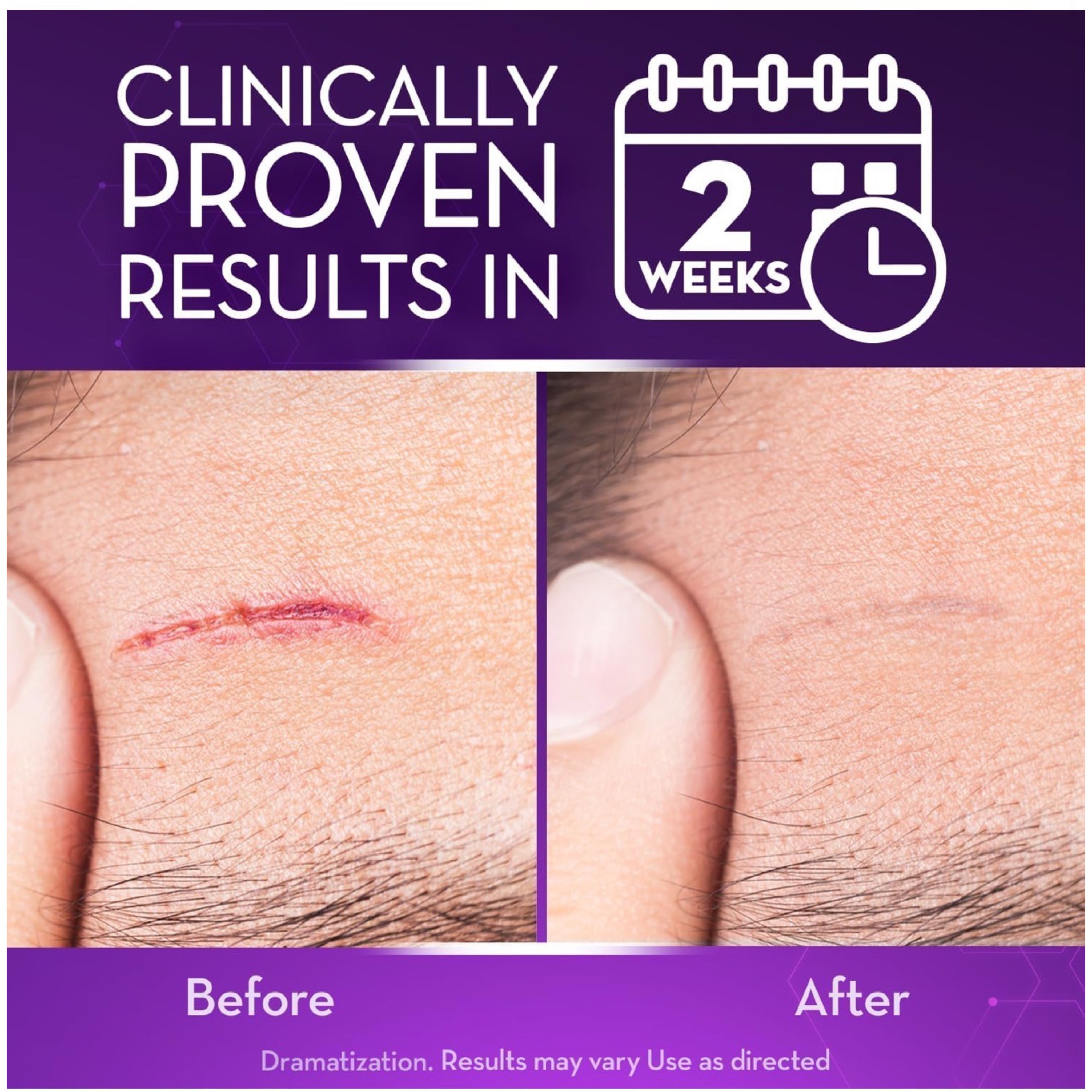 Cicatricure Face & Body Scar Gel